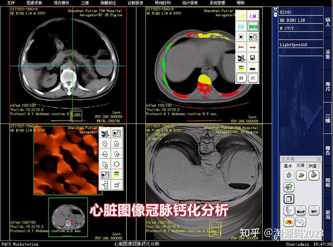 PACS系统如何实现高效的三维影像获取与处理？