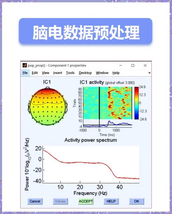 脑电信号分类中，有哪些数据预处理策略？