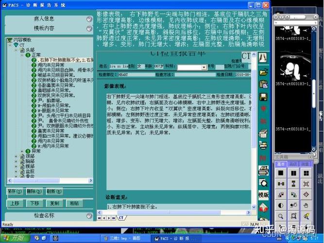 VC编程语言如何应用于支持图像后处理及影像PACS系统开发？