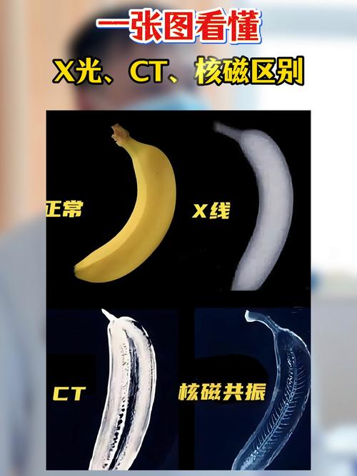 医学影像中，MRI、CT和X-ray的成像原理及概述是怎样的？