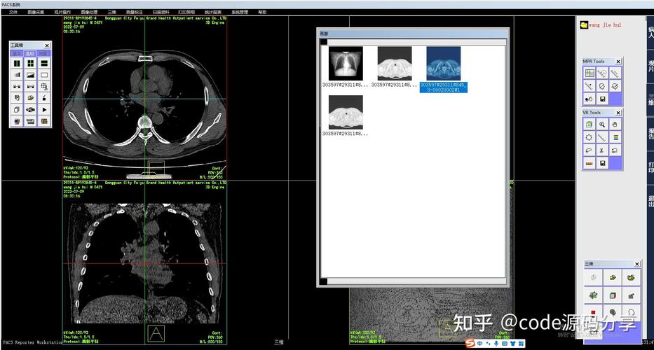 虚拟内窥镜（VE）应用中，哪四个关键技术至关重要？