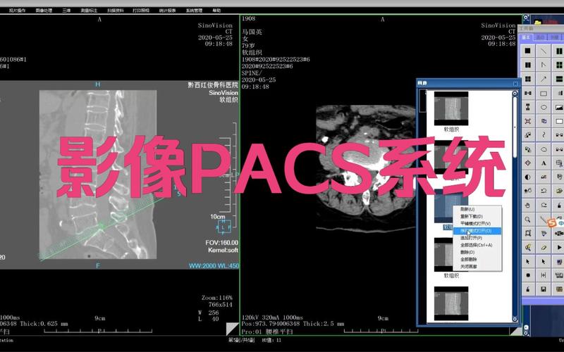 PACS系统如何实现三维影像的多平面重建与显示功能？