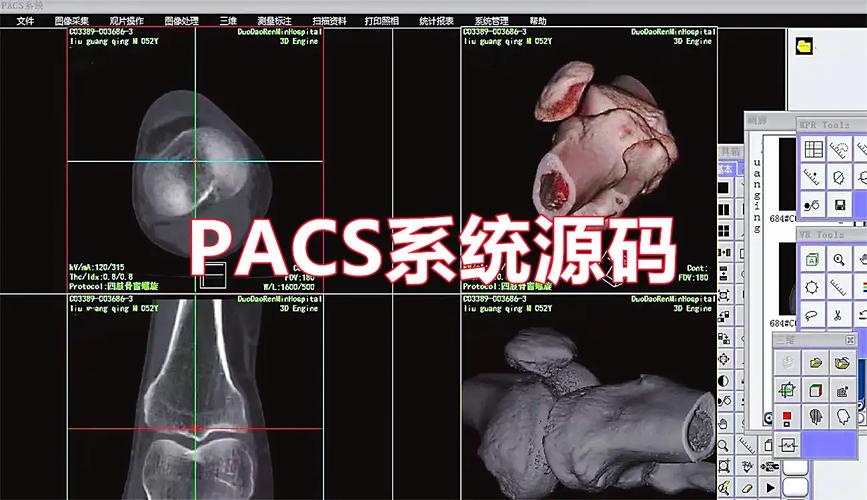 医院PACS系统中三维重建技术是如何原理及实现的？