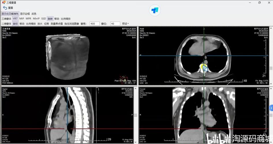 PACS系统中CT-MRI图像有哪些显著特点及广泛用途？