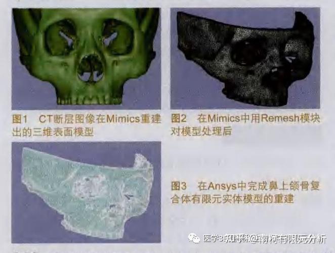 如何构建医学上鼻上颌骨复合体的三维有限元模型？