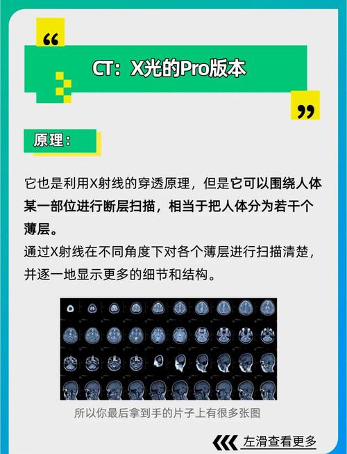 医学影像中，MRI、CT和X-ray的成像原理及概述是怎样的？