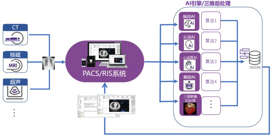 PACS系统中有哪些高级精准图像处理算法？