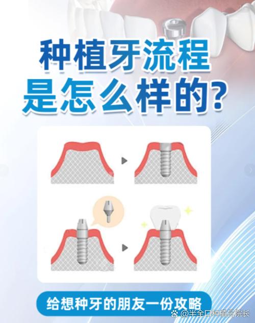 如何精准定位种植牙SEO，成为引流专家？