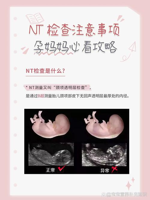 如何正确操作NT系统中的服务？