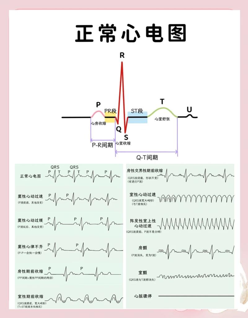 Swoole长连接心跳检测具体实现方法是什么？